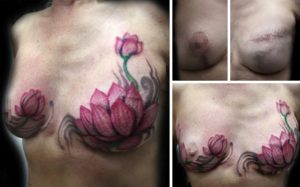tattoo e cicatrice mastectomia
